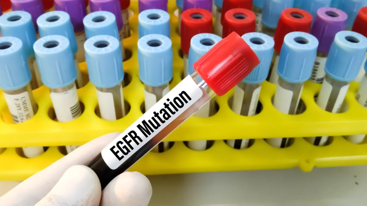 promising-breakthrough-in-non-small-cell-lung-cancer-zipalertinib-combination-demonstrates-significant-progression-free-survival-in-phase-iii-trial