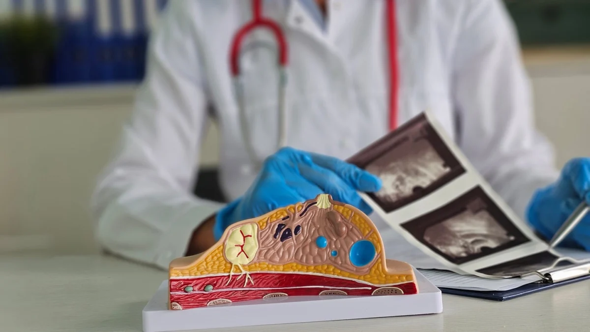 radnets-deephealth-secures-fda-clearance-for-ai-powered-breast-ultrasound-system-a-new-era-in-diagnostic-precision