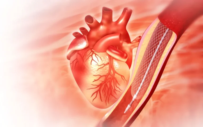 revolutionizing-cardiology-heartflows-ffr-ct-technology-slashes-unnecessary-invasive-procedures