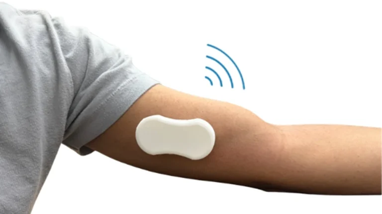 revolutionizing-dialysis-care-the-beacon-device-promises-early-detection-of-access-failure