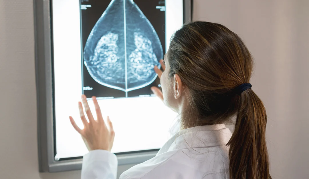 the-architecture-of-health-a-comprehensive-guide-to-breast-anatomy-and-pathology