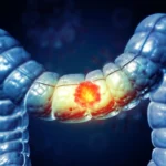 unraveling-the-colorectal-cancer-paradox-new-study-pinpoints-dual-roles-of-immune-cells-paving-way-for-precision-immunotherapy