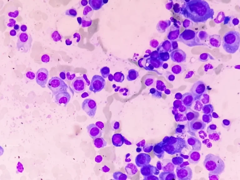 abbvies-etentamig-shows-promise-in-phase-iii-trial-poised-to-disrupt-competitive-multiple-myeloma-market