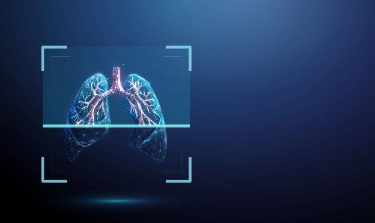 ai-powered-precision-brainomix-and-endeavor-biomedicines-reveal-breakthrough-in-idiopathic-pulmonary-fibrosis-imaging