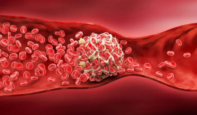 anaconda-biomed-secures-56m-to-disrupt-global-stroke-intervention-market