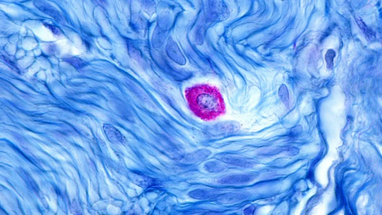 celldexs-barzolvolimab-shows-unparalleled-efficacy-in-chronic-hives-despite-safety-hurdles