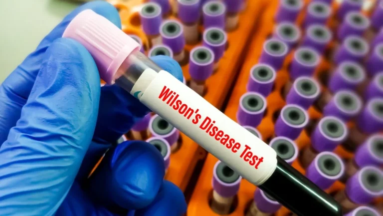 groundbreaking-global-trial-launched-for-novel-wilson-disease-treatment