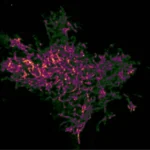 illuminating-the-invisible-how-finici-is-revolutionizing-subcellular-imaging-and-drug-discovery