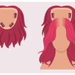 navigating-chemotherapy-induced-hair-loss-a-comprehensive-guide-to-wigs-and-empowerment