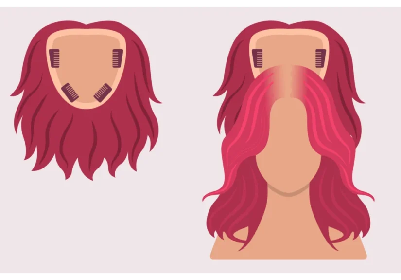 navigating-chemotherapy-induced-hair-loss-a-comprehensive-guide-to-wigs-and-empowerment