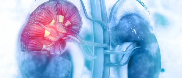 precision-oncology-in-renal-cell-carcinoma-exploring-adaptive-treatment-strategies-with-pembrolizumab-and-axitinib