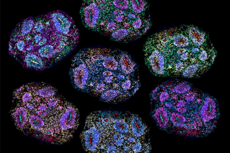 the-five-year-frontier-how-scientists-are-unlocking-the-secrets-of-the-human-brain-through-time-warp-organoids