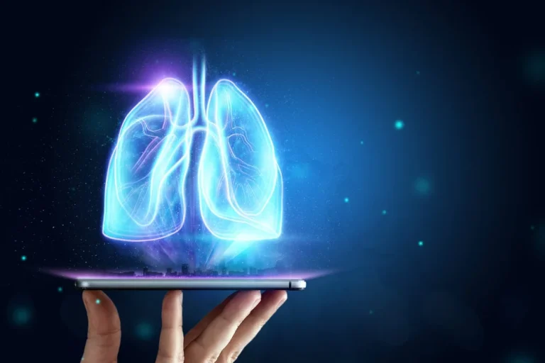 ai-powered-imaging-revolutionizes-pulmonary-fibrosis-trials-brainomix-e-lung-shows-promise-in-predicting-disease-progression-and-treatment-efficacy