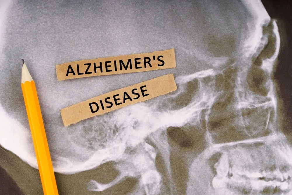 alzheimers-disease-market-poised-for-explosive-growth-driven-by-novel-therapies-and-evolving-treatment-paradigms