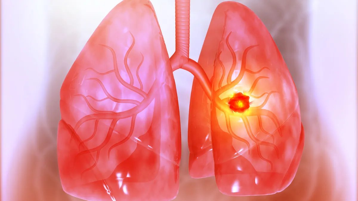 arrivents-ambitions-stumble-clinical-setback-in-lung-cancer-treatment-wipes-out-half-of-market-value
