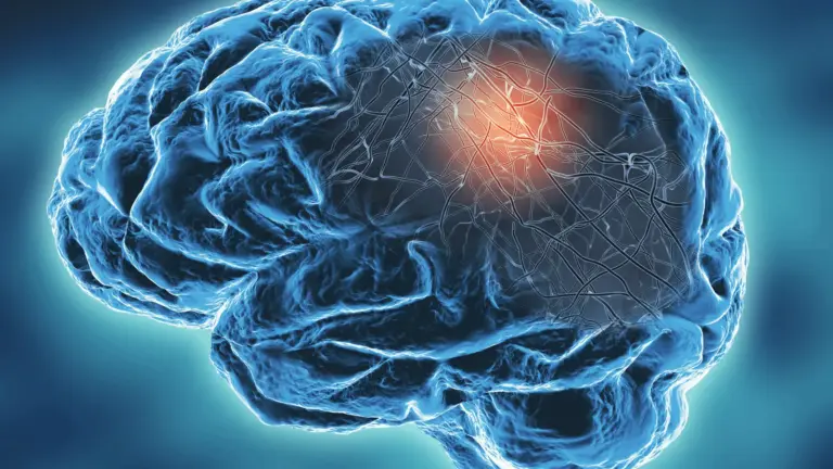 breakthrough-in-parkinsons-research-cerevance-reports-positive-late-stage-clinical-trial-results-for-solengepras