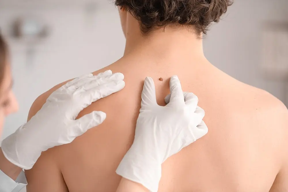 personalized-cancer-vaccine-shows-promise-but-data-leak-dampens-initial-enthusiasm